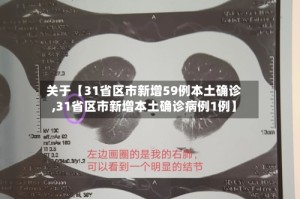关于【31省区市新增59例本土确诊,31省区市新增本土确诊病例1例】