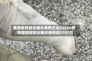 美国新冠肺炎确诊病例已达62086例/美国新冠肺炎确诊病例超3767万