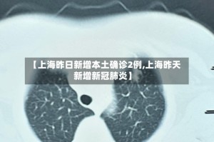 【上海昨日新增本土确诊2例,上海昨天新增新冠肺炎】