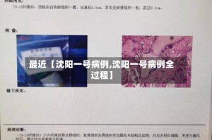 最近【沈阳一号病例,沈阳一号病例全过程】