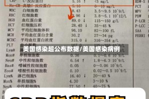 美国感染超公布数据/美国感染病例