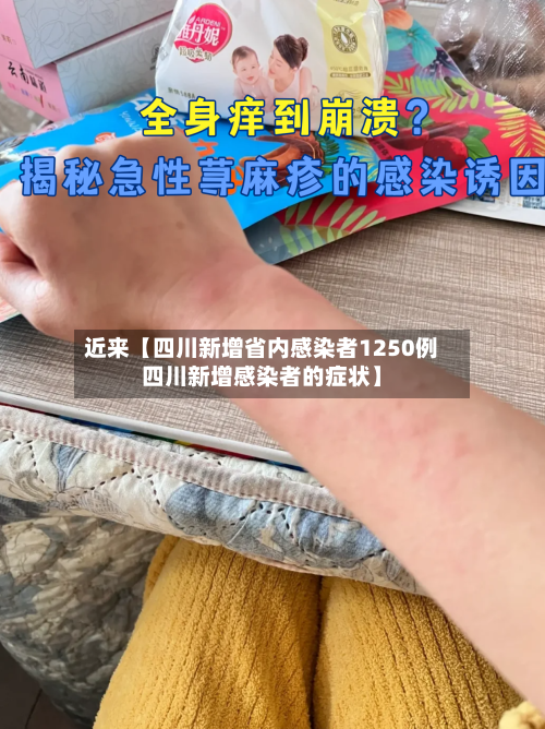 近来【四川新增省内感染者1250例四川新增感染者的症状】-第1张图片