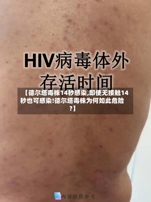 【德尔塔毒株14秒感染,即使无接触14秒也可感染!德尔塔毒株为何如此危险?】-第1张图片