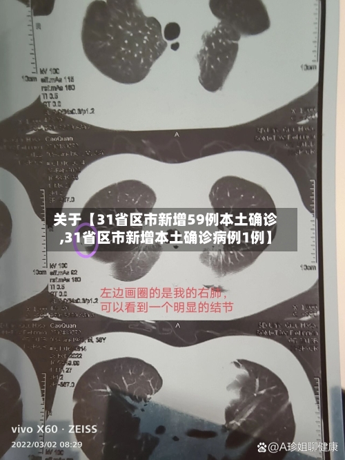 关于【31省区市新增59例本土确诊,31省区市新增本土确诊病例1例】-第1张图片