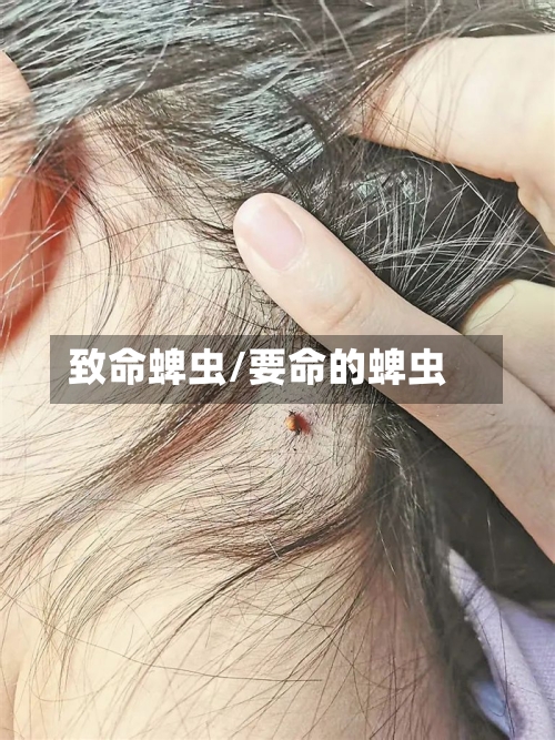 致命蜱虫/要命的蜱虫-第1张图片