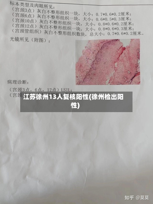 江苏徐州13人复核阳性(徐州检出阳性)-第1张图片