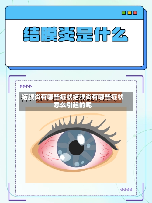 结膜炎有哪些症状结膜炎有哪些症状怎么引起的呢