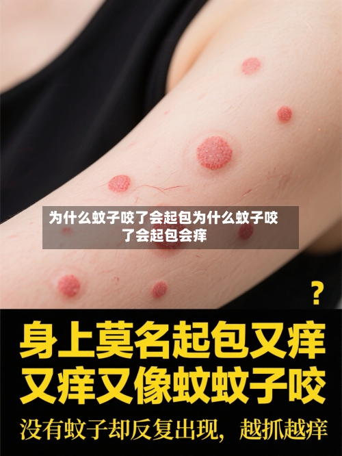 为什么蚊子咬了会起包为什么蚊子咬了会起包会痒