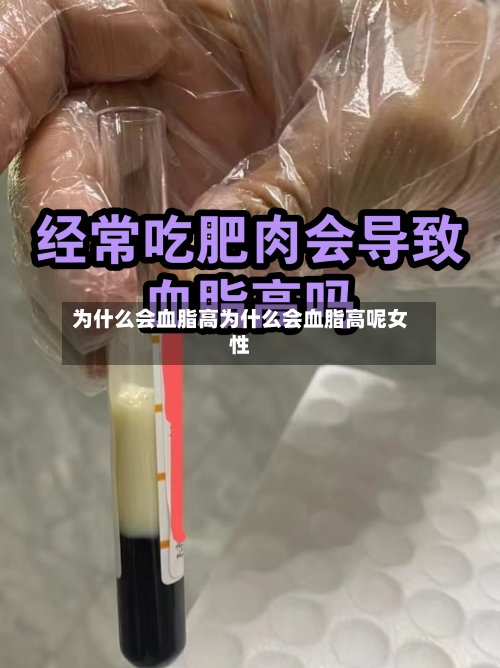 为什么会血脂高为什么会血脂高呢女性