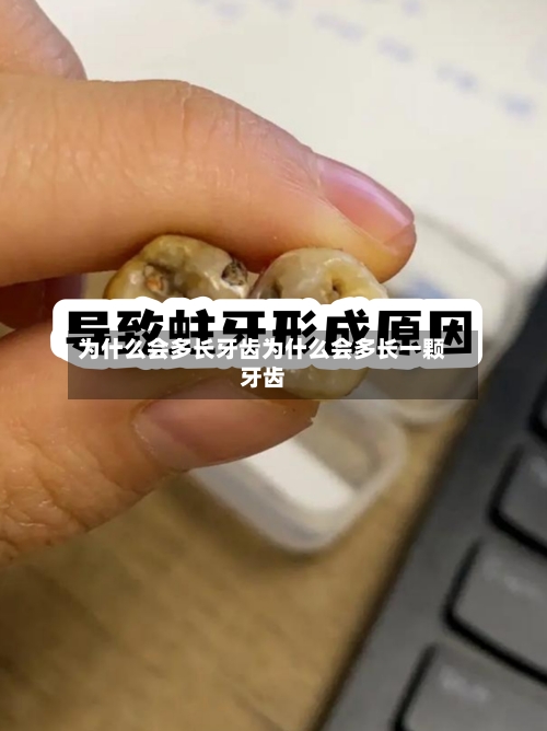 为什么会多长牙齿为什么会多长一颗牙齿