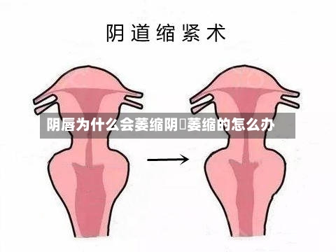 阴唇为什么会萎缩阴脣萎缩的怎么办