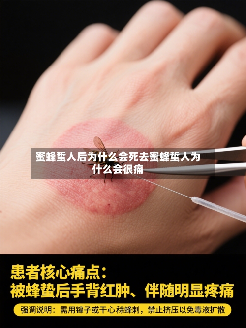 蜜蜂蜇人后为什么会死去蜜蜂蜇人为什么会很痛