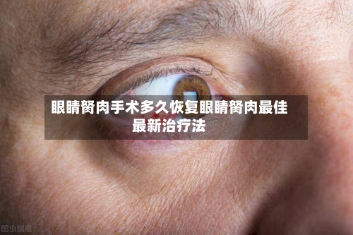 眼睛胬肉手术多久恢复眼睛胬肉最佳最新治疗法