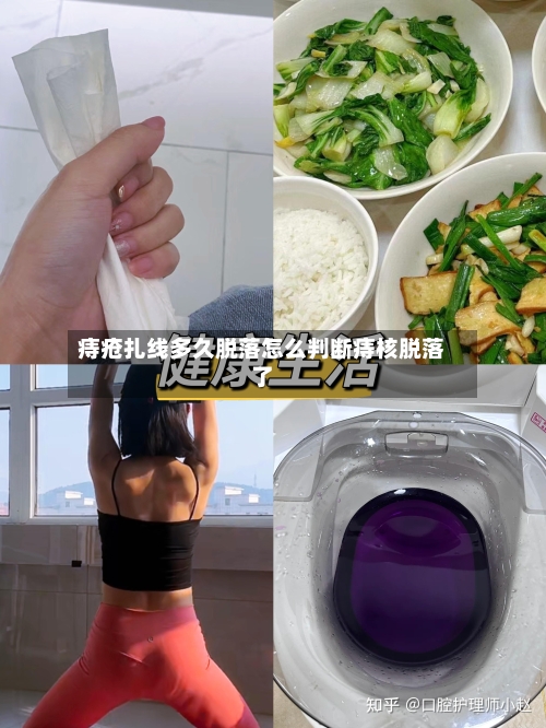 痔疮扎线多久脱落怎么判断痔核脱落了