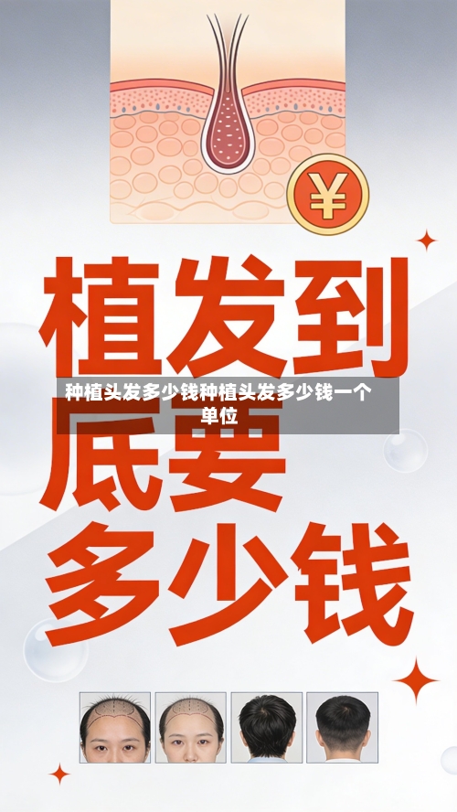 种植头发多少钱种植头发多少钱一个单位