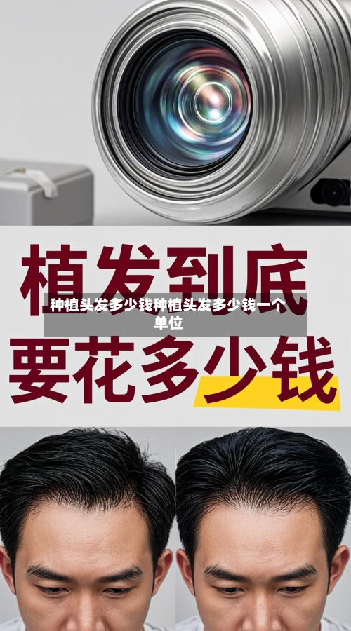 种植头发多少钱种植头发多少钱一个单位