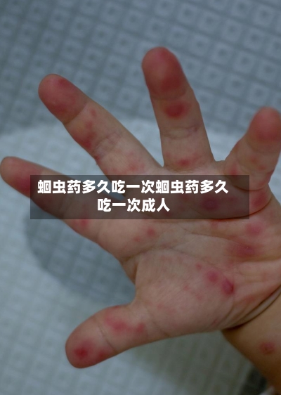蛔虫药多久吃一次蛔虫药多久吃一次成人