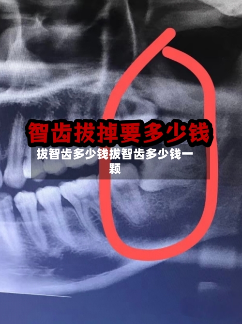 拔智齿多少钱拔智齿多少钱一颗