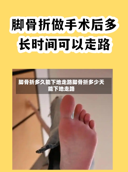脚骨折多久能下地走路脚骨折多少天能下地走路